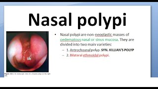 Tonsils  Clinical Anatomy Palatine lingual tubal adenoids [upl. by Anitsrik]