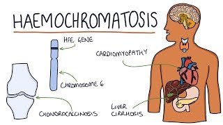 Understanding Haemochromatosis [upl. by Irpac]