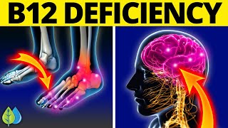 11 Weird Signs You Might Be Lacking Vitamin B12 [upl. by Lowe]