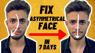 How To Fix Asymmetrical Face Easily  100 Working Exercise [upl. by Darrill]