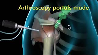 Rotator Cuff  3D Anatomy Tutorial [upl. by Metcalf]