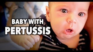 BABY WITH PERTUSSIS Whooping Cough  Dr Paul [upl. by Llyrat]