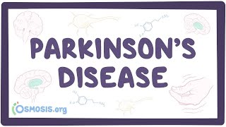 Parkinsons disease symptoms [upl. by Sisak117]