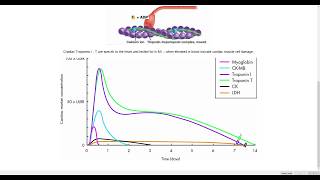 Troponin and MI [upl. by Kelcy]