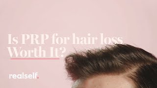 Is PRP for Hair Loss Worth It Everything You Need to Know About This Hair Restoration Procedure [upl. by Christin664]