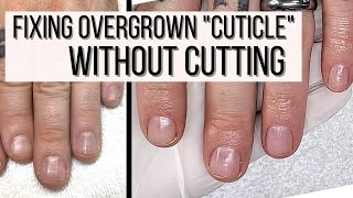 How to FIX Overgrown Cuticles WITHOUT CUTTING [upl. by Nosille]