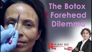 Botox Forehead Dilemma Explained Dr Rajani [upl. by Patton]