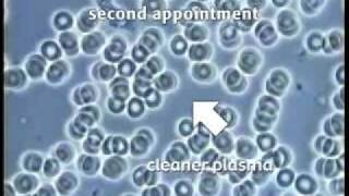 Live Blood Microscopy Demonstration Part 1 [upl. by Irafat]