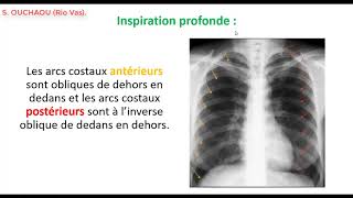 Comment interpréter une radiographie thoracique de face  Partie 1 [upl. by Aixela197]