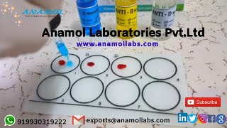 Blood Grouping Test Procedure [upl. by Novar]