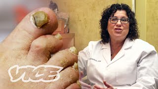 Meet a Toenail Fungus Expert [upl. by Ackerman]