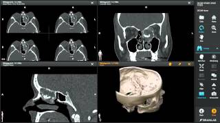 DICOM Viewer—Medical Image Manipulation [upl. by Ahsak]