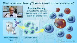 How is melanoma treated with immunotherapy [upl. by Onibag273]