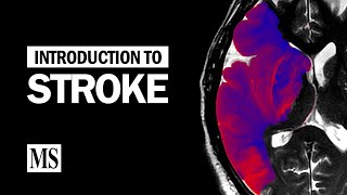 NIH Stroke Scale Training  Part 4  Demo Patient B [upl. by Sheridan328]