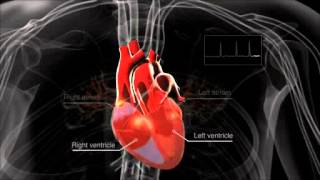 What is atrial fibrillation [upl. by Arlin]