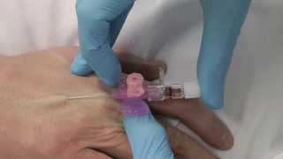 Cannulation How to gain IV access [upl. by Etnom]