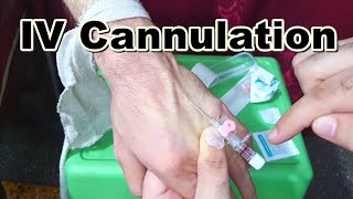 How to Insert IV Cannula  IV Cannulation Technique  Branula  Intravenous Catheter [upl. by Anelleh]