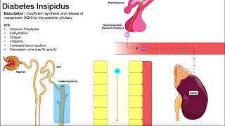 Diabetes Insipidus  Overview causes pathophysiology investigations [upl. by Etireuqram892]