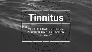 Wie hört sich ein Tinnitus an [upl. by Nylirret161]