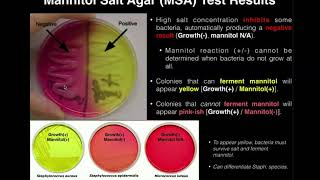 Listeria monocytogenes tumbling motility [upl. by Teevens670]