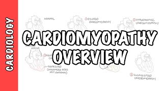 Cardiomyopathy Overview  types dilated hypertrophic restrictive pathophysiology and treatment [upl. by Casey]