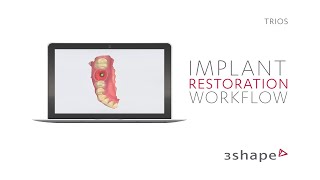 3Shape TRIOS  Implant restoration workflow [upl. by Strickman518]