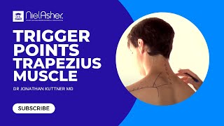 Trapezius Trigger Points  Self Treatment [upl. by Anahcar]