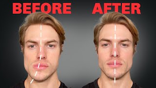 How to Fix Asymmetrical Jaw amp Face FOREVER [upl. by Risay]