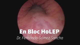 En Bloc HoLEP with early apical liberation [upl. by Ethbinium]