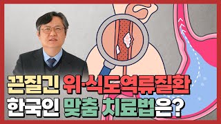 역류성식도염 치료 꼭 약을 장기간 복용해야 하나요 [upl. by Atinihs]