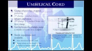 Critical Care Paramedic 16 Obstetrical Neonatal and Pediatric Emergencies [upl. by Irahcaz]