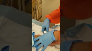 Arteriovenous AVF Cannulation 101 [upl. by Christos]