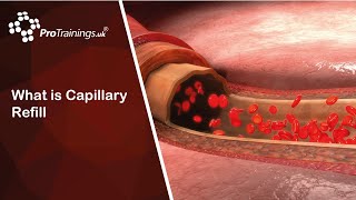 What is Capillary Refill [upl. by Stormie549]