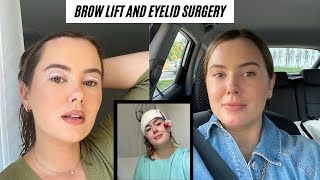 Brow Lift Masseter Frontalis and Glabella Botox Treatment  AAFE [upl. by Delacourt]