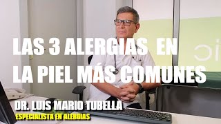 Los 3 tipos de ALERGIAS EN LA PIEL más comunes ⭐ ¿ Se cura la Dermatitis  ⭐ SmartSalus [upl. by Monteria]