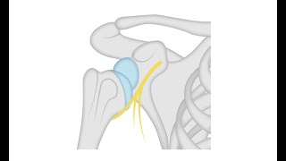 SLAP Repair Arthroscopic Double loaded anchor Y config [upl. by Janeen106]