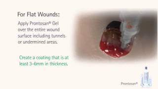 Pensar Medical WoundPro® Negative Pressure Wound Therapy Control Unit Inservice [upl. by Assirrec]