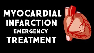 Myocardial Infarction MIHeart Attack Treatment in Emergency  Step wise STEMI Management USMLE [upl. by Fronia]