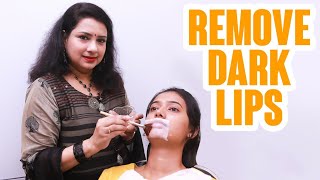 How to Lighten Dark Lips  Naturally  Home remedies [upl. by Bourke17]