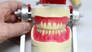 How Dentures Are Made [upl. by Battiste]