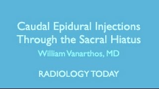 Ultrasound Imaging for Thoracic Epidural Insertion [upl. by Eeruhs]