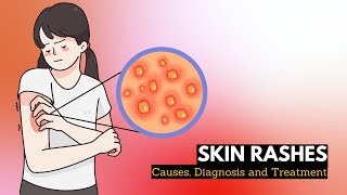 Skin Rash Causes Signs and Symptoms Diagnosis and Treatment [upl. by Enoj269]