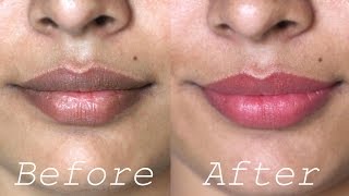 How to Lighten Dark Lips Naturally  Rapid Home Remedies [upl. by Tiat25]