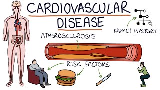 Understanding Cardiovascular Disease Visual Explanation for Students [upl. by Tuesday]