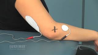 Electrode Placement for Supination Option 1 [upl. by Nikolaos]