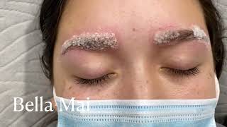 Eyebrow Salt and Saline Removal [upl. by Kohsa]