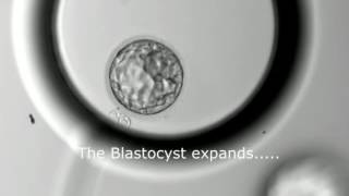 Blastocyst Development  Day 3 to Day 5 MUST SEE [upl. by Yltnerb]