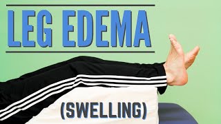 What is Edema or swollen feet and legs [upl. by Enylcaj]