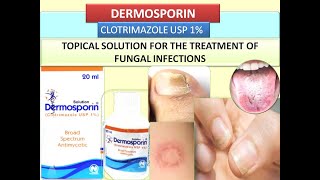 Clotrimazole Topical Solution  Dermosporin Review  Treatment of Skin amp Nails Fungal Infections [upl. by Faden]