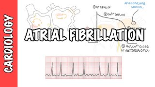 Atrial Fibrillation Overview  ECG types pathophysiology treatment complications [upl. by Dennett299]